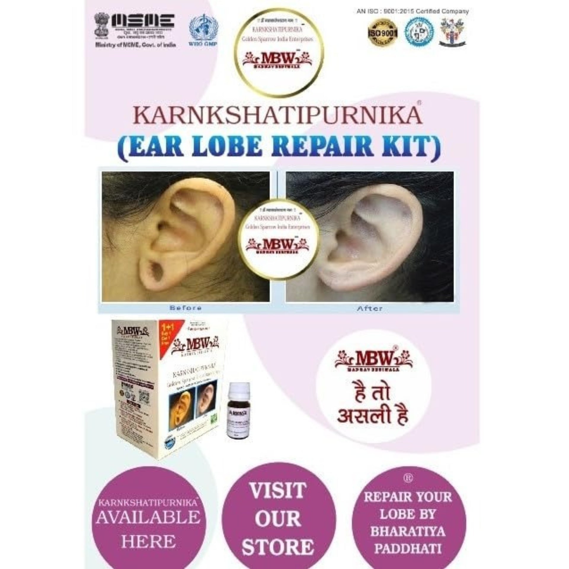 Advertisement for MBW Karnkshatipurnika Ear Lobe Repair Kit with images of an ear before and after use, and product packaging.