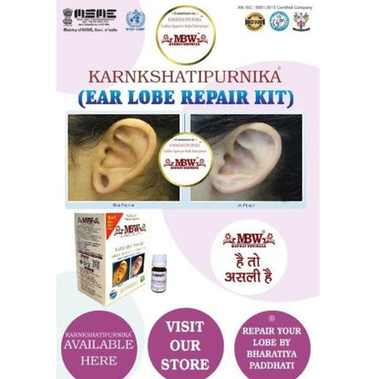 Advertisement for MBW Karnkshatipurnika Ear Lobe Repair Kit with images of an ear before and after use, and product packaging.
