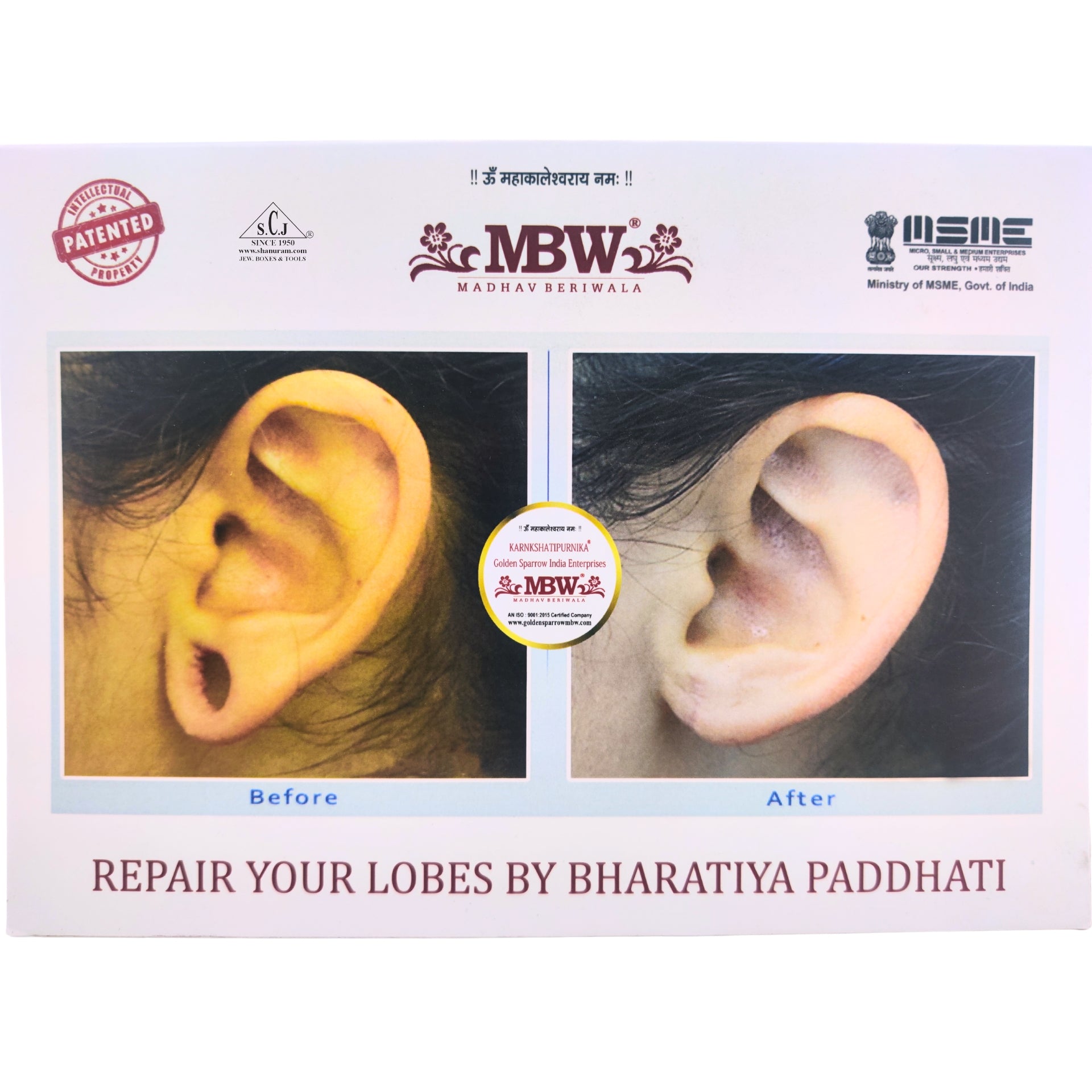 Advertisement showing before and after ear repair with MBW logo and text.